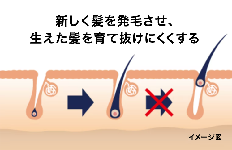 新しく髪を発毛させ、生えた髪を育て、抜けにくくする。