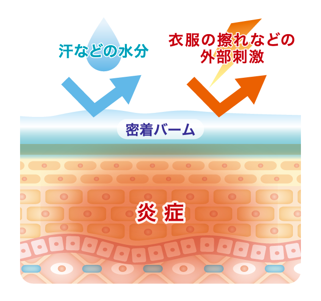 クリニラボ メディロイドVS軟膏の特長、抗炎症ストロングランクのステロイド成分配合