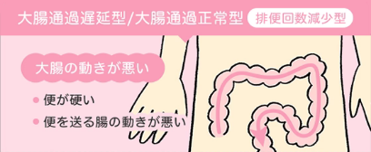 「便が出ない」便秘のタイプ（排便回数減少型）には、大腸通過遅延型と大腸通過正常型の2種があり、便が硬かったり、便を送る腸の動きが悪いため便秘になる。