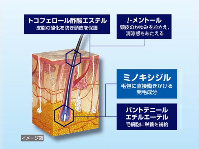 ミノキシジルのほかに、プラスした頭皮環境を整える3つの成分が、髪の毛に作用するイメージ図