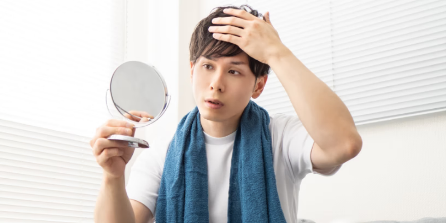 薄毛が気になる男性のイメージ写真