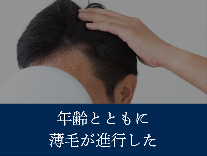年齢とともに薄毛が進行した