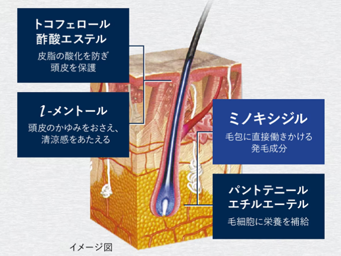 ミノキシジルのほかに、プラスした頭皮環境を整える3つの成分が、髪の毛に作用するイメージ図