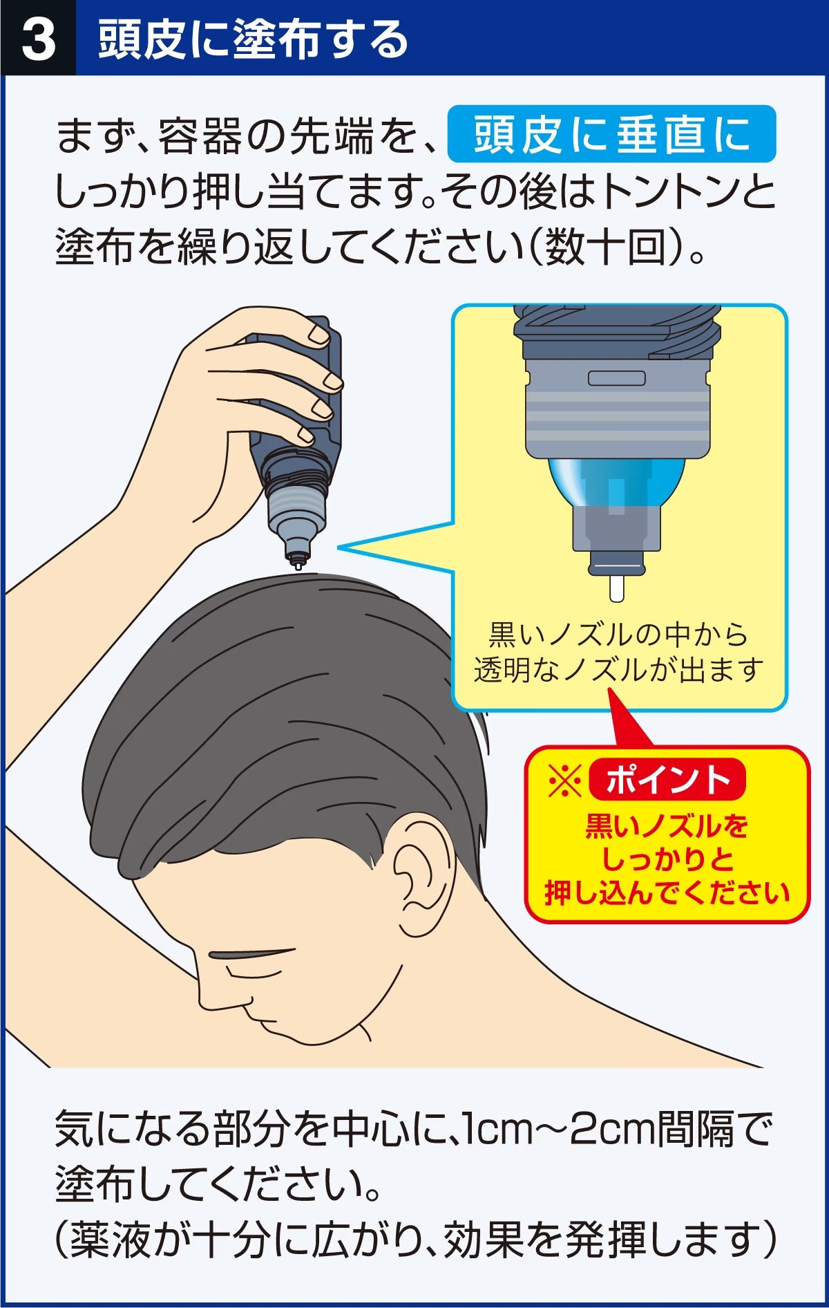 頭皮に塗布する。まず、容器の先端を頭皮に垂直にしっかり押し当てます。黒いノズルの中から透明なノズルが出ます。黒いノズルをしっかりと押し込んでください。その後はトントンと塗布を繰り返してください（数十回）。気になる部分を中心に1cm～2cm間隔で塗布してください。（薬液が十分に広がり、効果を発揮します）