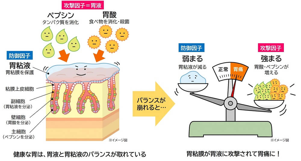 胃液と胃粘液のバランス