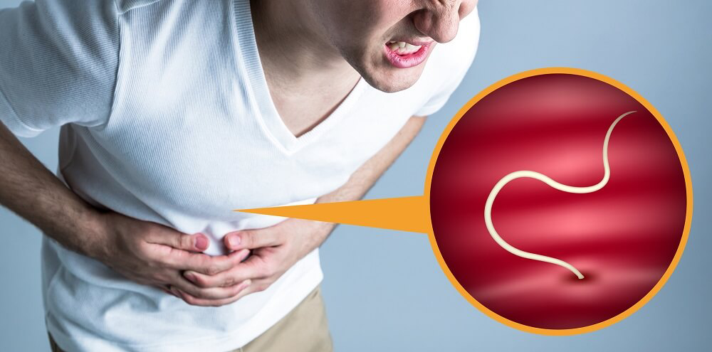 （３）食後の激しい胃痛は、アニサキスなど食中毒の可能性も