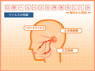 口唇ヘルペス再発のしくみ ウイルスの移動