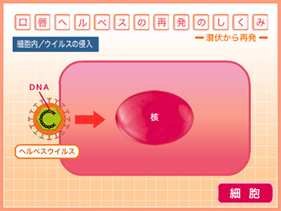 口唇ヘルペス再発のしくみ 細胞内ウイルスの侵入