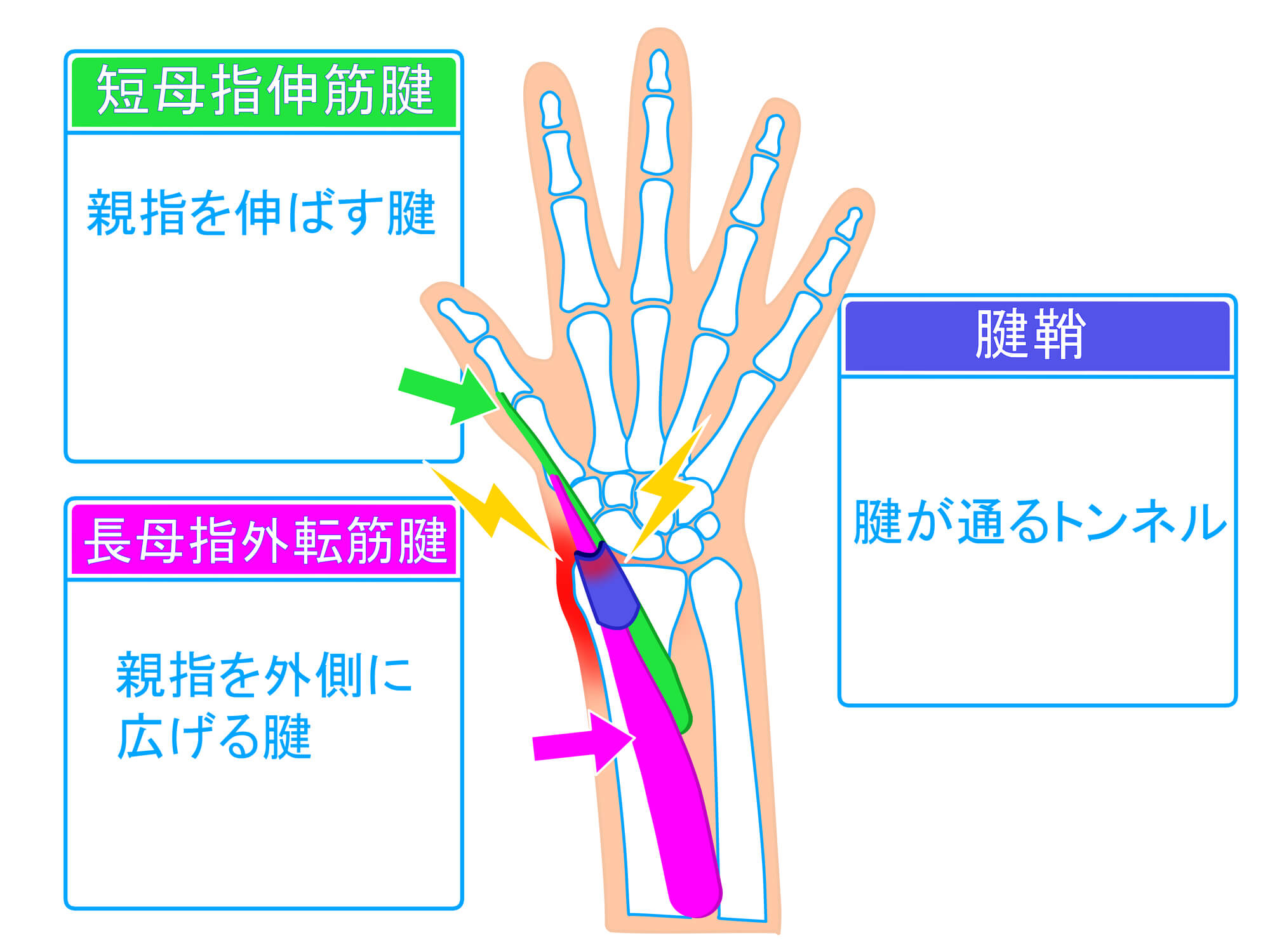 腱鞘炎における「腱」と「腱鞘」の関係