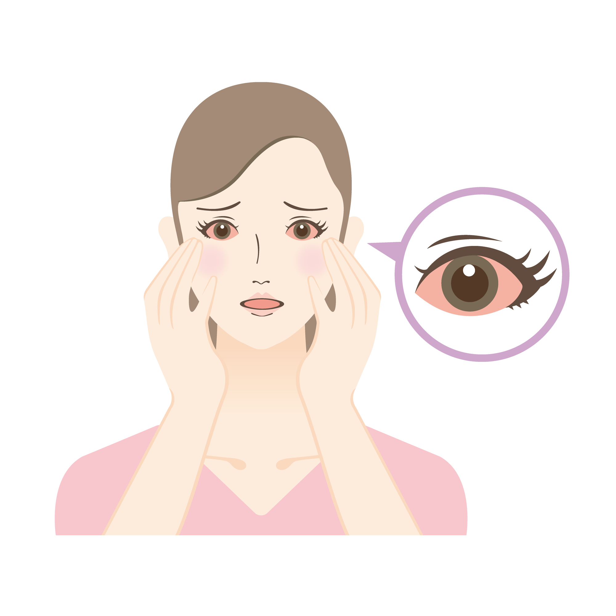 結膜炎とはどんな病気？ 主な症状は？