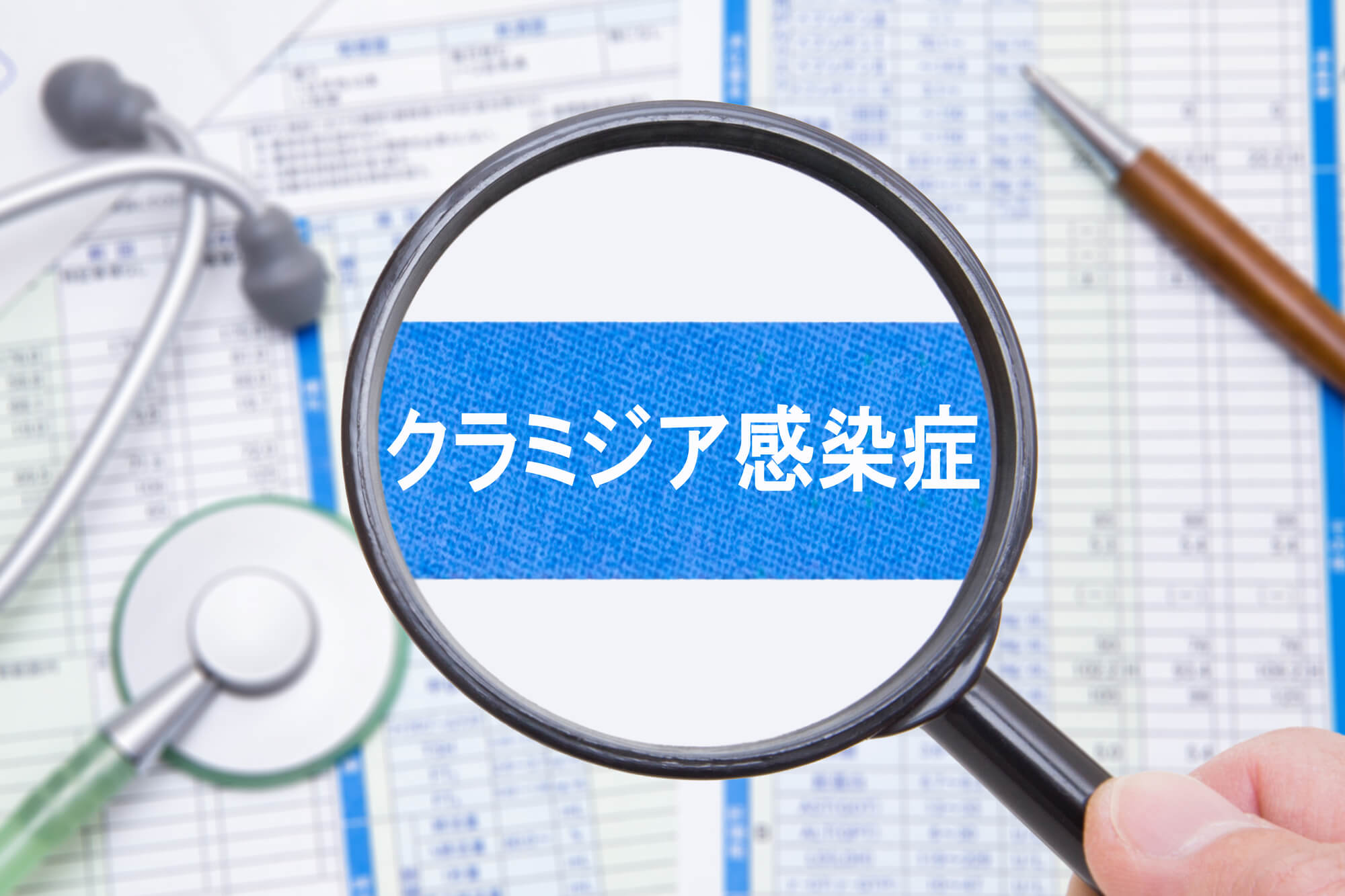 淋菌性結膜炎／クラミジア結膜炎