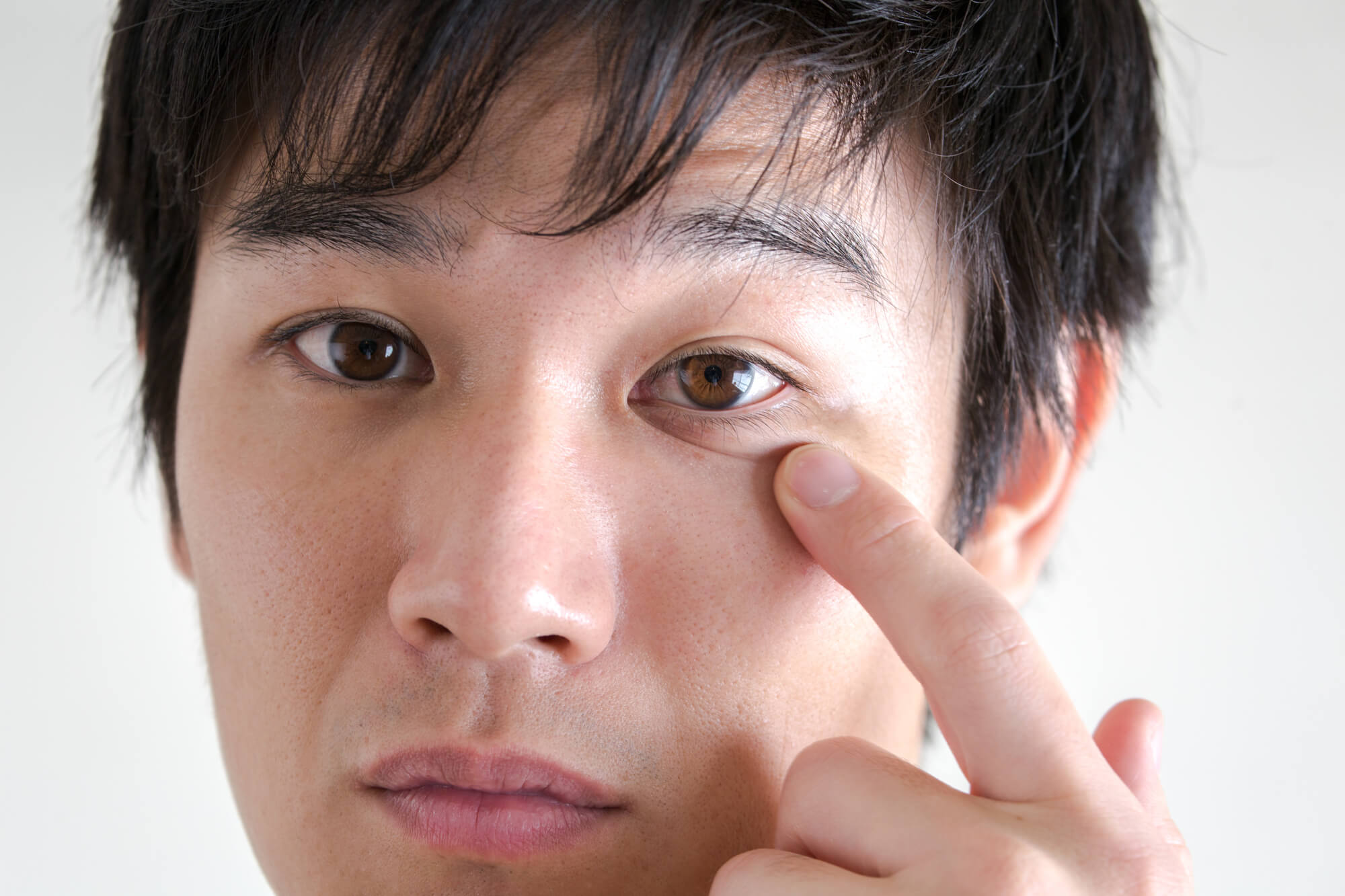 細菌性結膜炎は「抗菌目薬」を使用し、症状が改善しなければ受診を