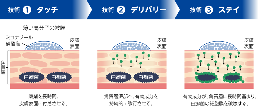 【技術①】タッチ（薬剤を長時間、皮膚表面に付着させる）【技術②】デリバリー（角質層深部へ、有効成分を持続的に移行させる）【技術③】ステイ（有効成分が、角質層に長時間留まり、白癬菌の細胞膜を破壊する）