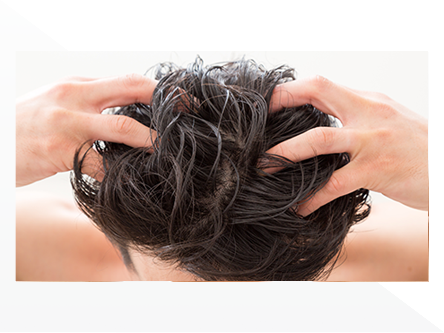 “蓄積皮脂”は発毛剤・育毛剤の浸透に影響